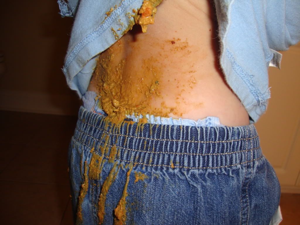 Please Help! *** Warning Nasty Poop Pictures*** Celiac Disease