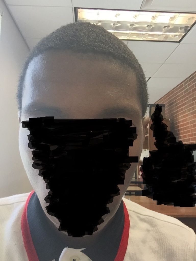 Hairline1.jpg